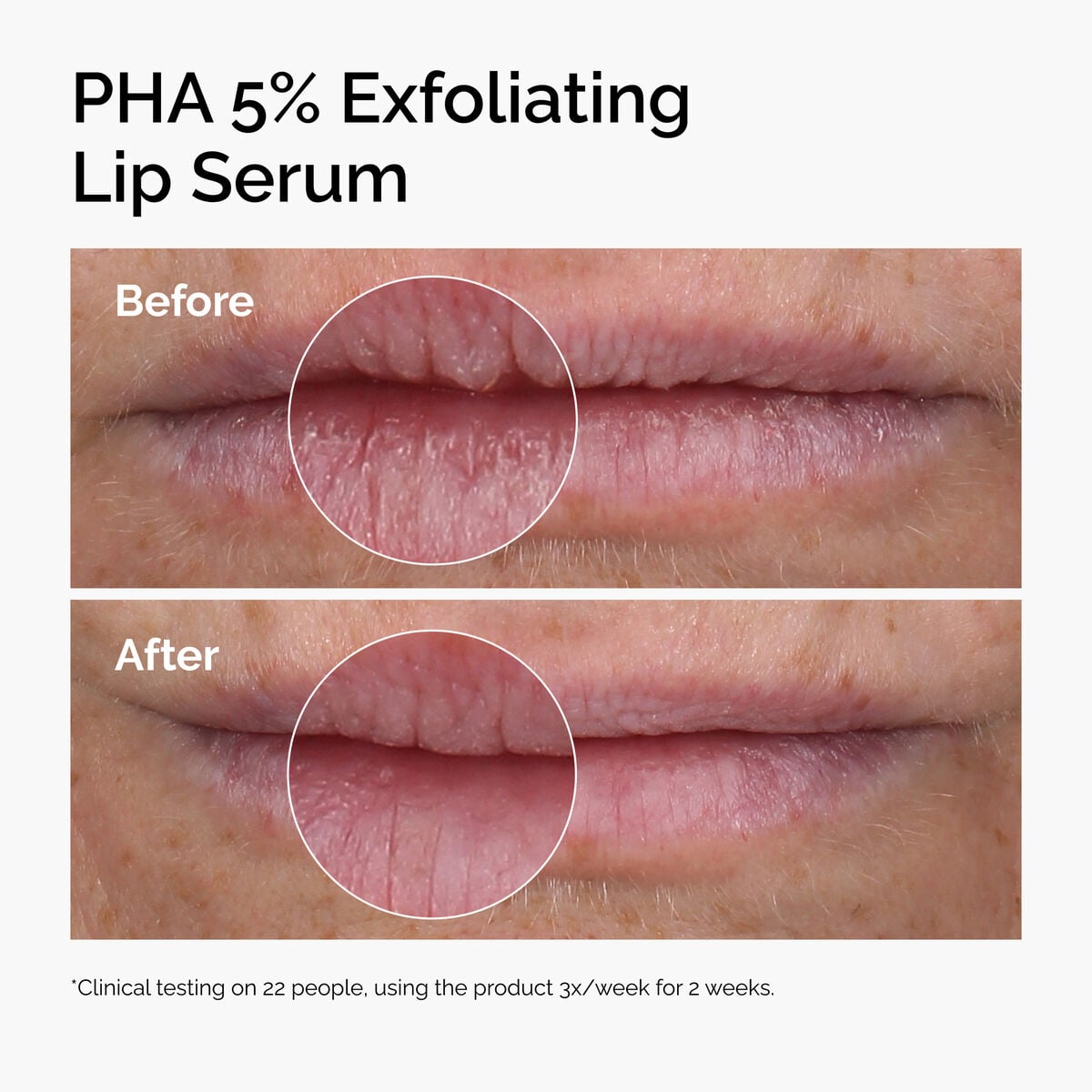 pha-5-exfoliating-lip-serum-q6 ord-pha-5pct-lip-exfoliating-serum-before-after.jpg